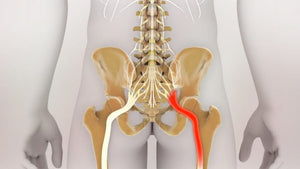Spine Example