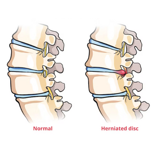 Spine Example