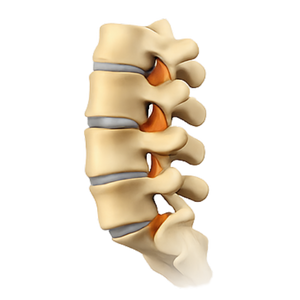 Spine Example