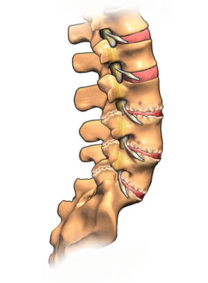 Spine Example